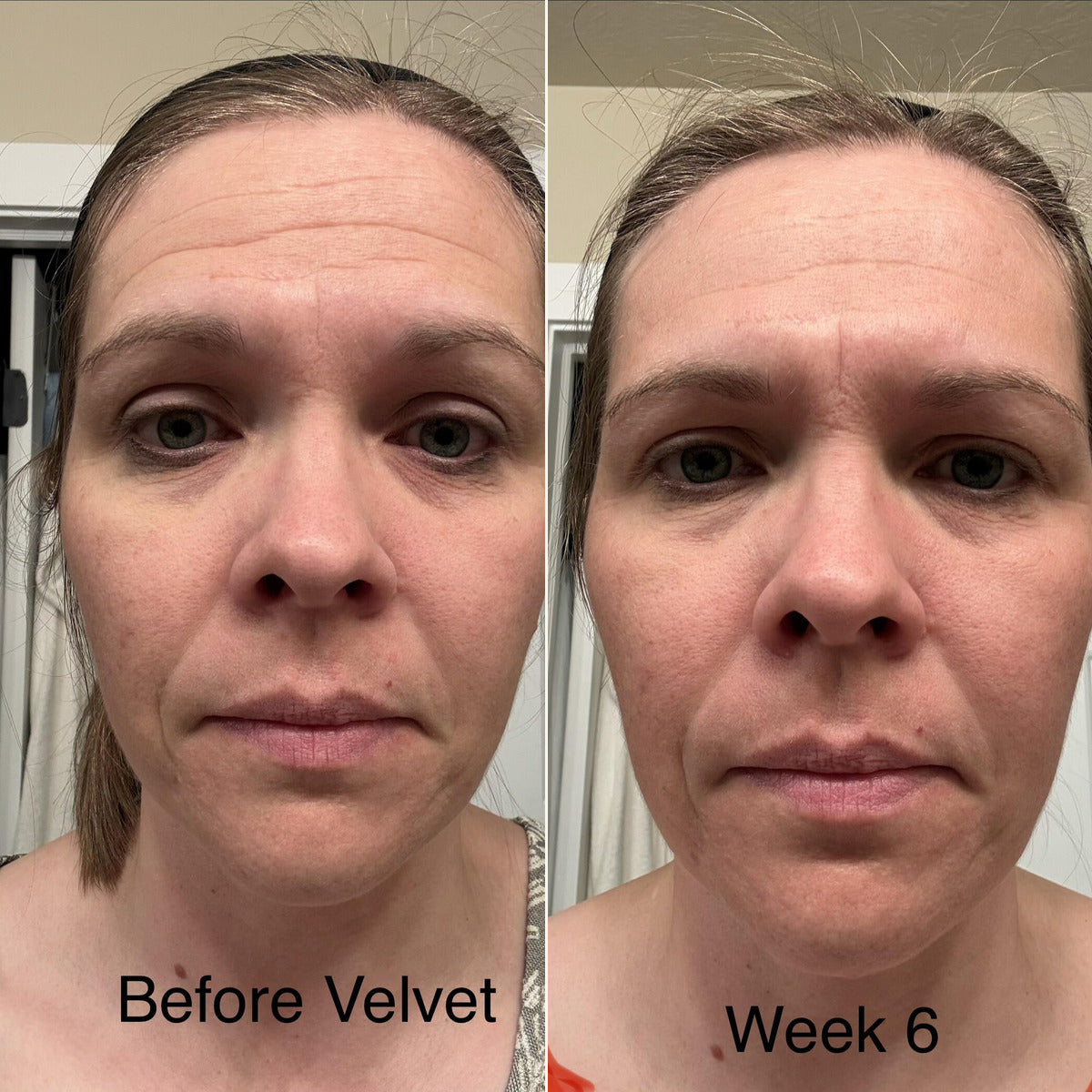 Alison Harris, verified buyer, Velvet Face Renewal before and after at six weeks