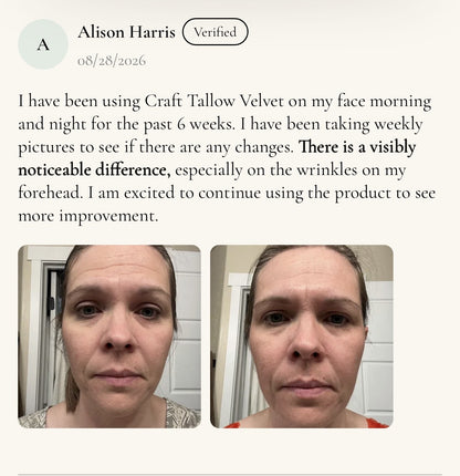 Alison Harris, verified buyer, six weeks of Velvet Face Renewal, before and after